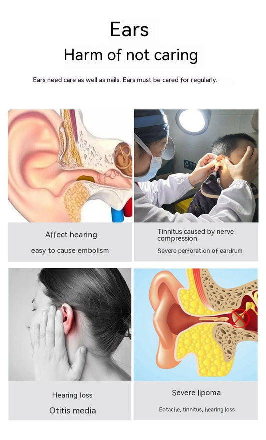 "Wireless HD Smart Ear Cleaning Endoscope – Luminous Visual Ear Pick Tool with Camera"